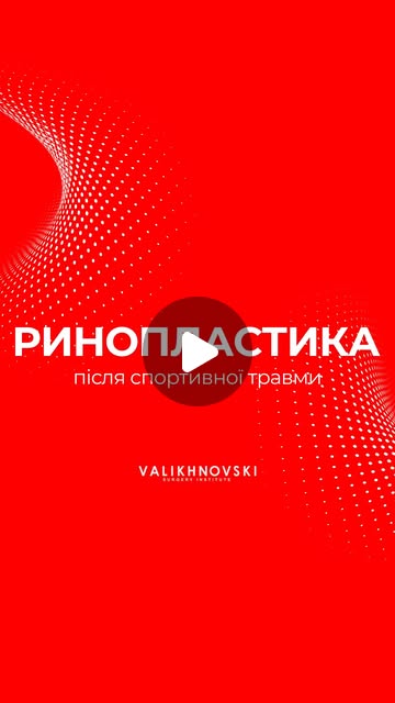 Обложка Instagram Reels о ринопластике после спортивной травмы